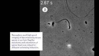 Semen Analysis for Male Infertility [upl. by Terza]