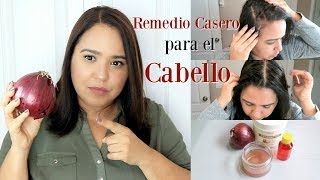 Jugo de Cebolla para la Caída del Cabello y Crecimiento [upl. by Lamok]