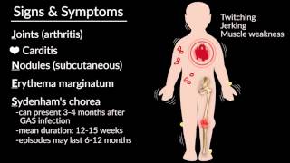 Acute Rheumatic Fever by E Rusingiza  OPENPediatrics [upl. by Eynobe]