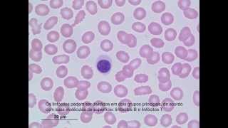 Classificação de Leucócitos [upl. by Eachelle]