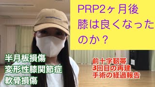 最新！PRP皮膚再生療法。実際に受けて見た。 [upl. by Scheck]