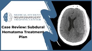 Case Review Subdural Hematoma Treatment Plan [upl. by Odarbil]