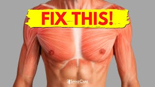 How to Fix Chest Muscle Tightness in 30 SECONDS [upl. by Columba]