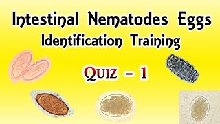 Intestinal Nematodes Eggs Identification Training Quiz 14 [upl. by Ydnyl]