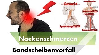 NACKENSCHMERZEN amp HWS Bandscheibenvorfall  Symptome Ursachen amp Lösungen [upl. by Yrrac]