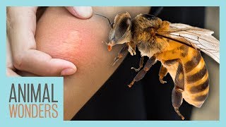 What You Need To Know About Bee Stings [upl. by Aicargatla]