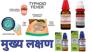 typhoid fever treatment in hindi [upl. by Drofnil56]