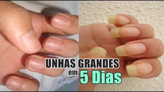 Como Fazer as unhas Crescerem em 5 dias [upl. by Meid]