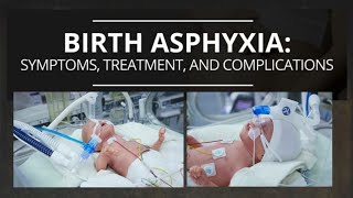 BIRTH ASPHYXIA  NEONATAL ASPHYXIA  SIGN AND SYMPTOMS  TYPES INCIDENCES Managing birth Asphyxia [upl. by Anauqed]