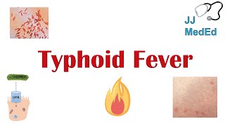 Typhoid Fever Pathogenesis vectors bacteria Symptoms Diagnosis Treatment Vaccine [upl. by Brunhild]