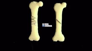 Strain Theory in Bone Fracture [upl. by Hayyifas]