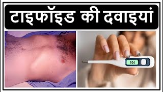 Typhoid Fever Explained  Causes Symptoms Treatment amp Prevention  OneHealth Hospital Vandalur [upl. by Calli326]