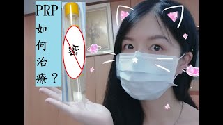 那些醫生沒告訴你的事！自體高濃度血小板血漿療法PRP介紹！PRP跟玻尿酸，我應該怎麼選？請開字幕About Autologous Platelet Therapy [upl. by Roon302]