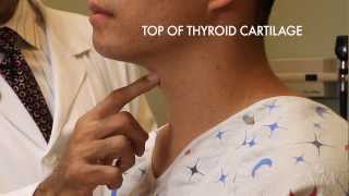 The Thyroid Exam Stanford Medicine 25 [upl. by Sadira]