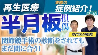 【変形性膝関節症】PRP療法（再生医療）の効果を体験談を交えて医師が解説 [upl. by Chernow987]