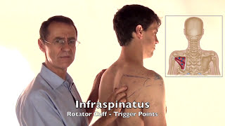 Trigger Point Release  Infraspinatus Muscle [upl. by Enrahs]