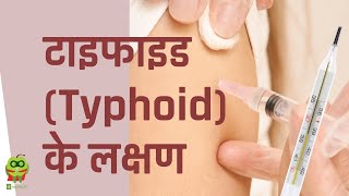 Typhoid का जबर्दस्त diet plan  typhoid me kya khana chahiye  typhoid fever treatment foods [upl. by Almeria774]