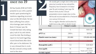 osce 19 dental clinical exams part 2 ORE MFDS MJDF LDS UK spoken [upl. by Tamer]