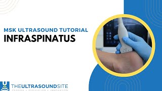 How to view the Infraspinatus tendon on ultrasound [upl. by Mansur]